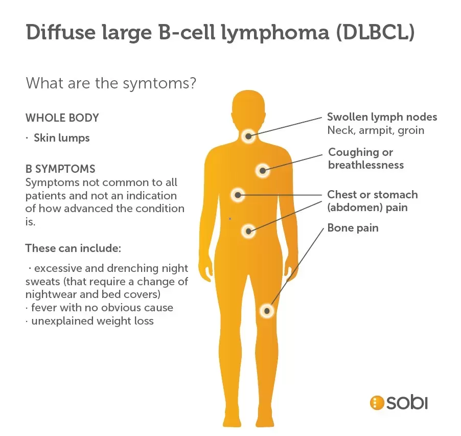 Diffuse large B cell lymphoma (DLBCL) symptoms
