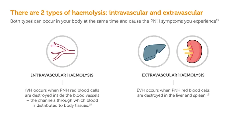 Sobi explanation, types of haemolysis.