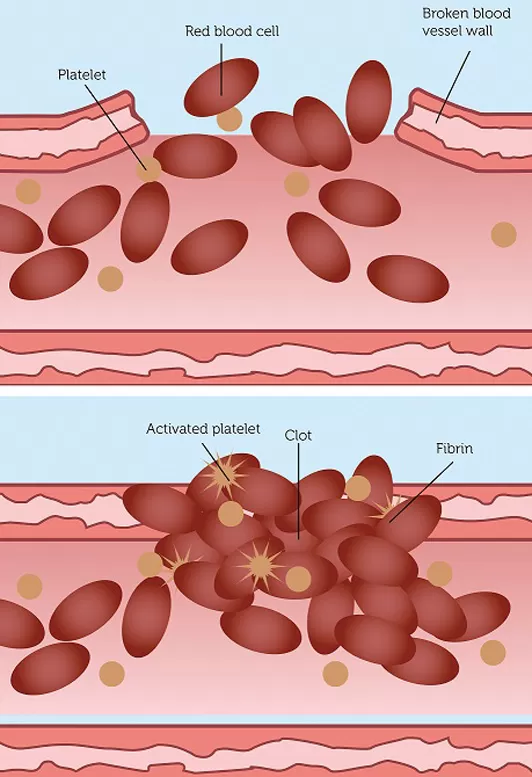 Platelet infographic diagram.